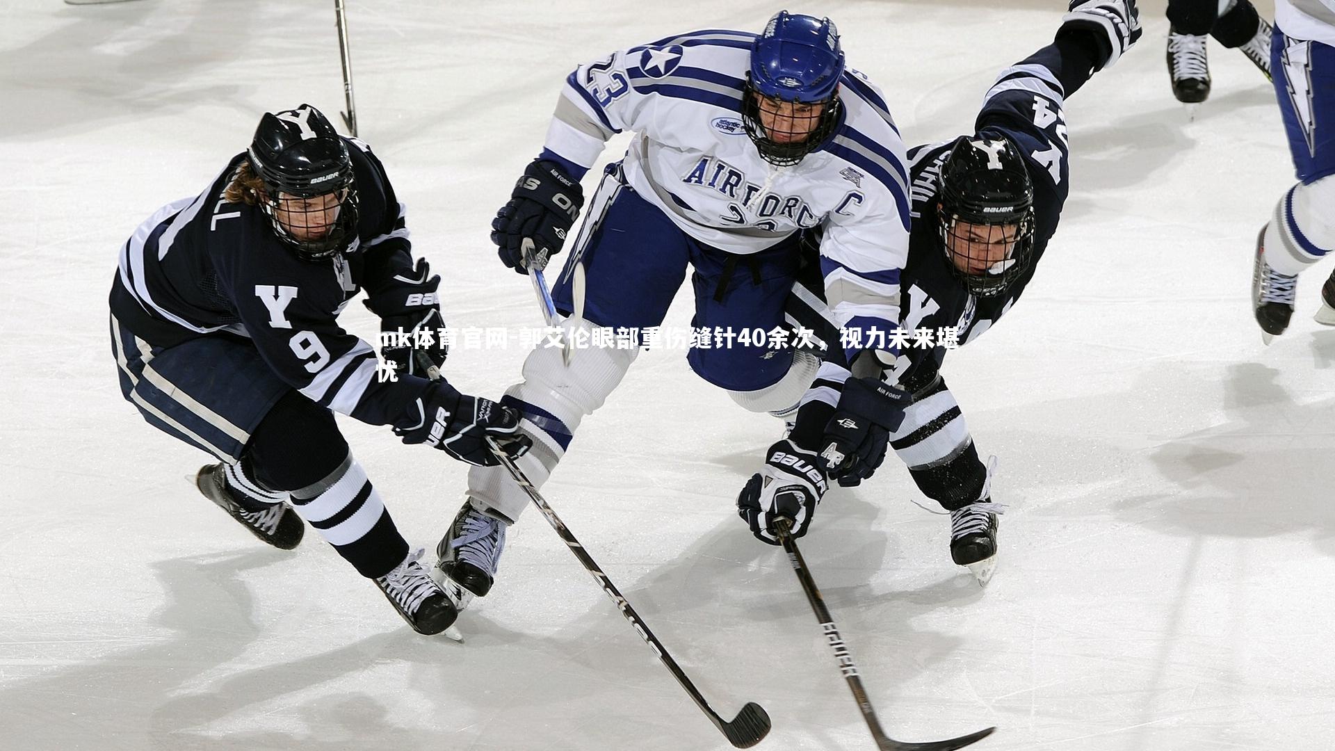 mk体育官网-郭艾伦眼部重伤缝针40余次，视力未来堪忧-第1张图片-mk体育官网